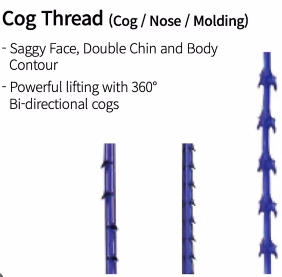 리프팅 및 터닝 변환 키트, 미세 나사